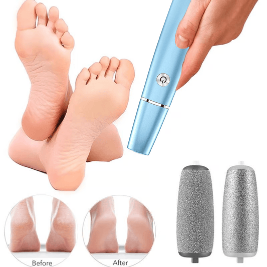 Electric foot callus remover kit for smooth heels, includes extra rollers, before and after results
