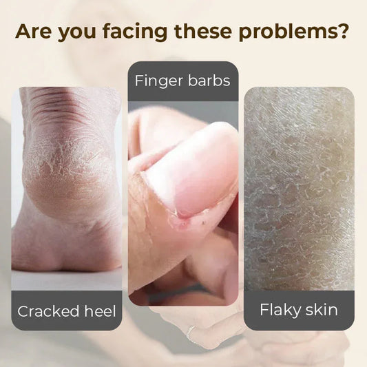 Dry skin issues on heel, finger, and arm including cracked heel, finger barbs, and flaky skin