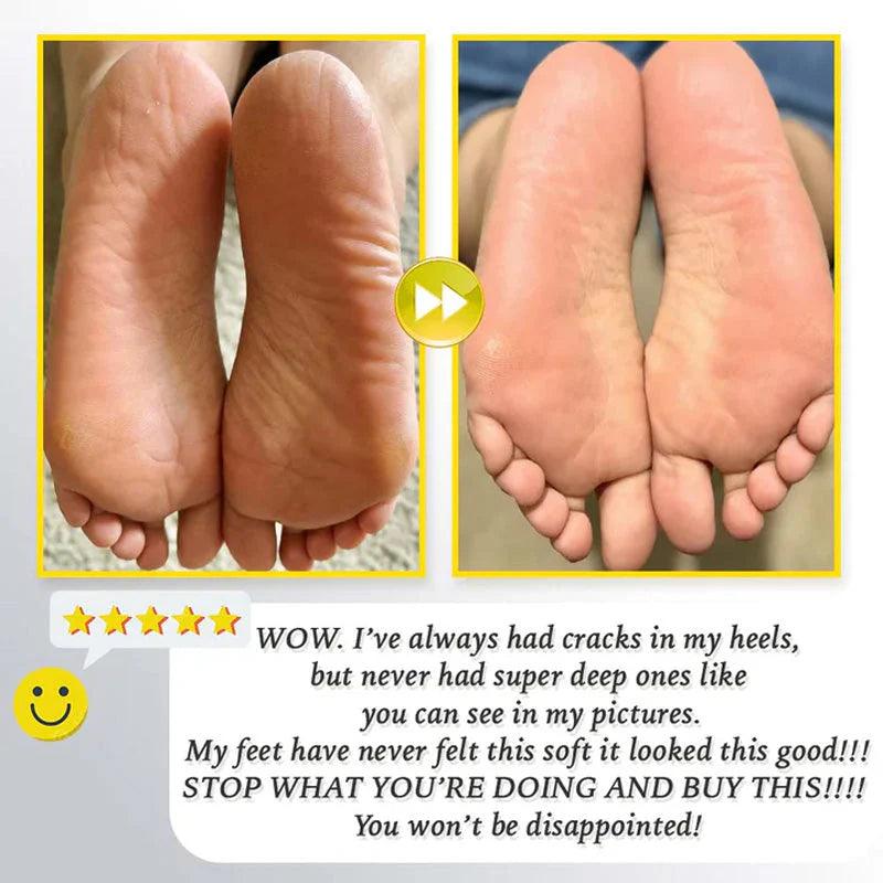 🔥HOT SALE 49% OFF🔥Rechargeable Electric Foot Exfoliating Scrubber - clarioy