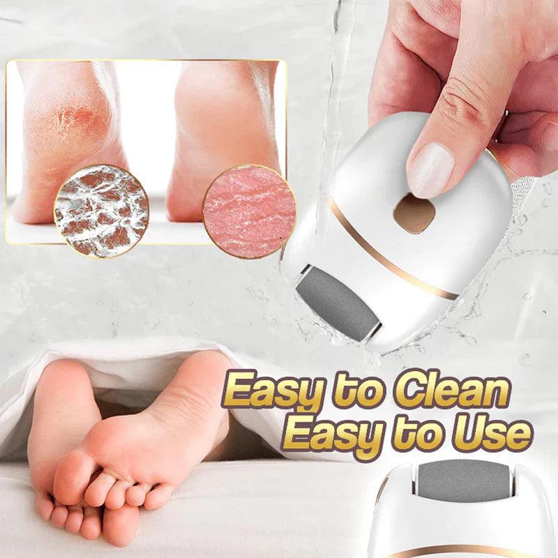 🔥HOT SALE 49% OFF🔥Rechargeable Electric Foot Exfoliating Scrubber - clarioy