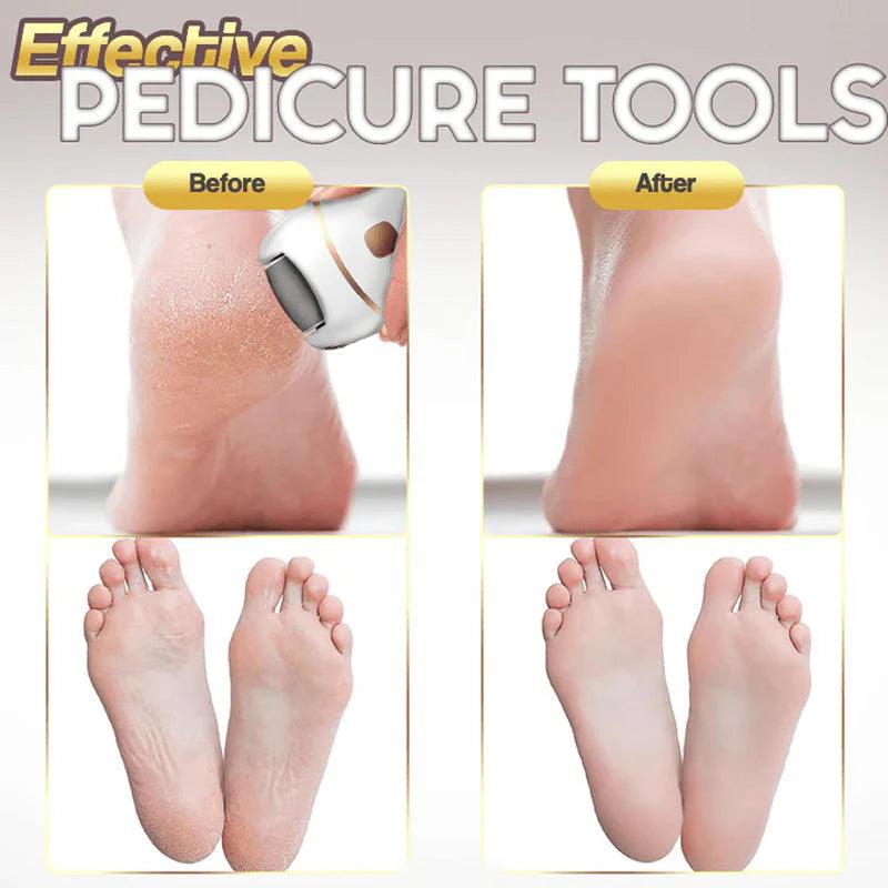 🔥HOT SALE 49% OFF🔥Rechargeable Electric Foot Exfoliating Scrubber - clarioy
