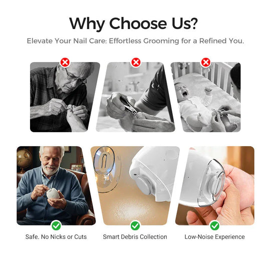 Clarioy electric nail trimmer safe nail care benefits, smart debris collection, low-noise device