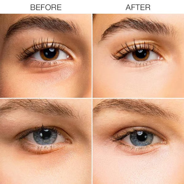 🏆 💐Buy 2 Get 1 Free🎁Under-Eye Brightener Cream – Dark Circle Correction & Fine Line Smoothing