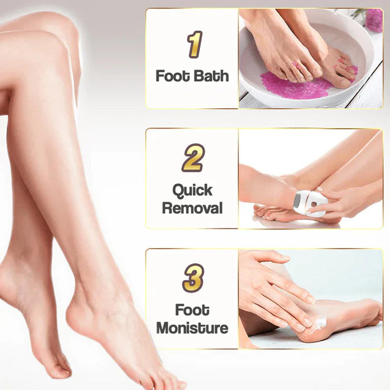 🔥HOT SALE 49% OFF🔥Rechargeable Electric Foot Exfoliating Scrubber