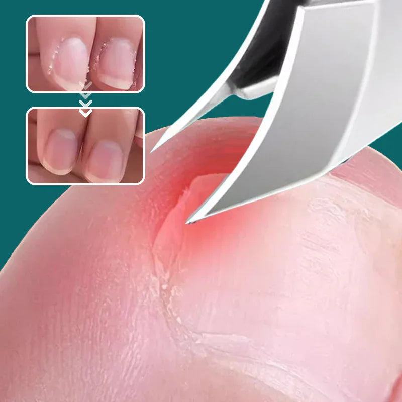💅 50% OFF NOW! ✨ Anti-Splash 25° Slant Edge Nail Clipper 3-Piece Set – Precise Cut, Comfortable Grip & Safe Splash Guard ✂️