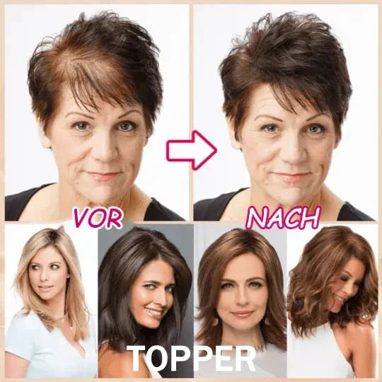 Breathable Natural Hair Tips for Women with Thinning Hair🔥Only $19.99 Last Day 💥