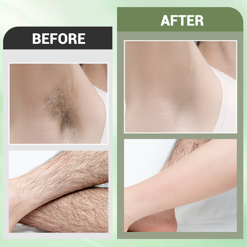 🥳2026 HOT SALE🥳💞50K+ SOLD!💥👵🌸 50% OFF!3-in-1 Cleansing, Exfoliating, and Hair Removal Set