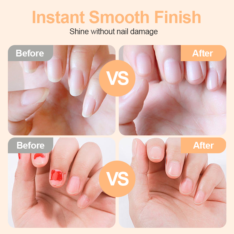 ⏳Time-Limited Special⏰2-in-1 Smart Electric Nail Trimmer & Polisher for All Ages 👨‍👩‍👧‍👦 – Blade-Free, Blood-Free & Stress-Free Nail Care! 💅