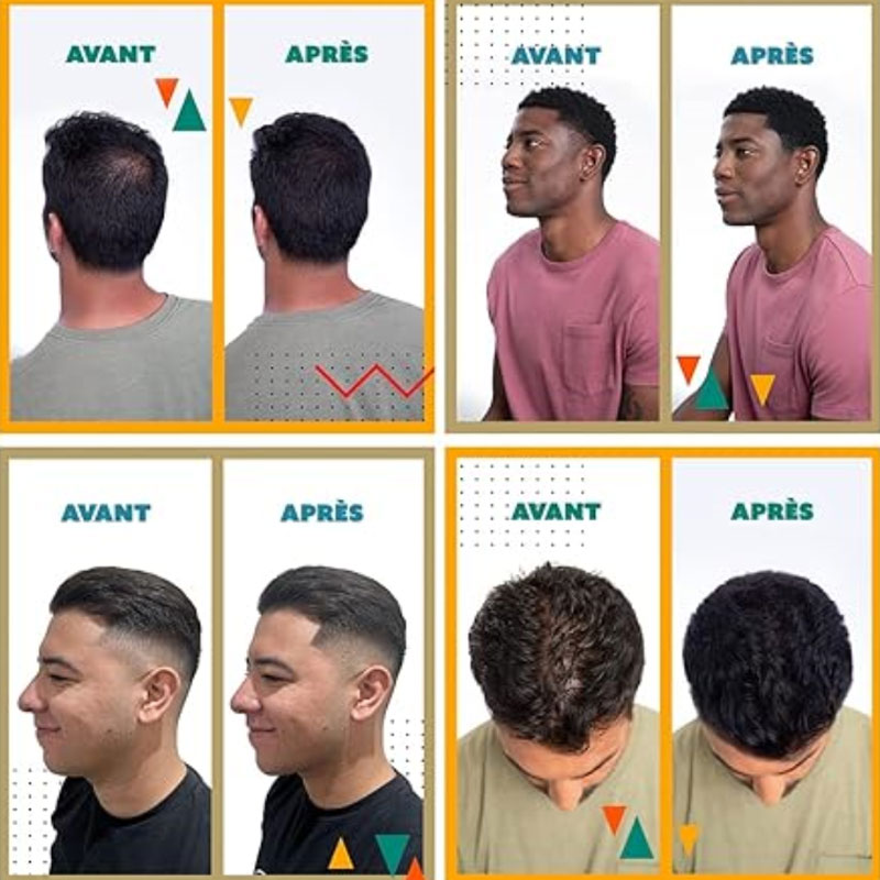 ⏰🔥LIMITED TIME 50% OFF!🔥50K+ SOLD! Hair Building Fibers Set for Thinning Hair & Bald Spots