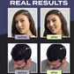 ⏰🔥LIMITED TIME 50% OFF!🔥50K+ SOLD! Hair Building Fibers Set for Thinning Hair & Bald Spots